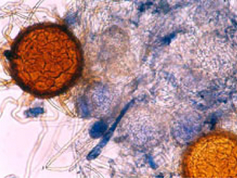 Mikroskopische Aufnahme der Hauptfruchtform (Chasmothezien). Braunrote Kreise in einer dunkelblauen Masse