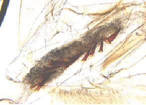Mikroskopische Aufnahme des männlichen Genitales des Baumwollkapselwurms