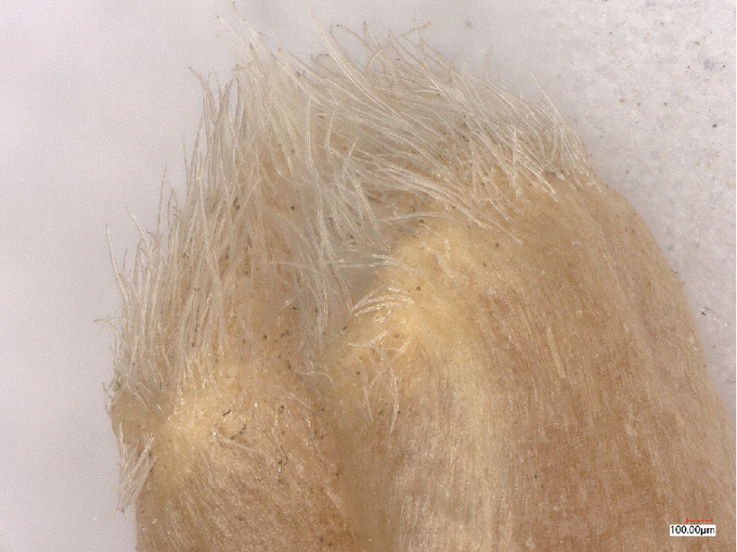 Vergrößerte Aufnahme von den Weizenhärchen eines Kornes, in welchen dunkle Pilzsporen hängen