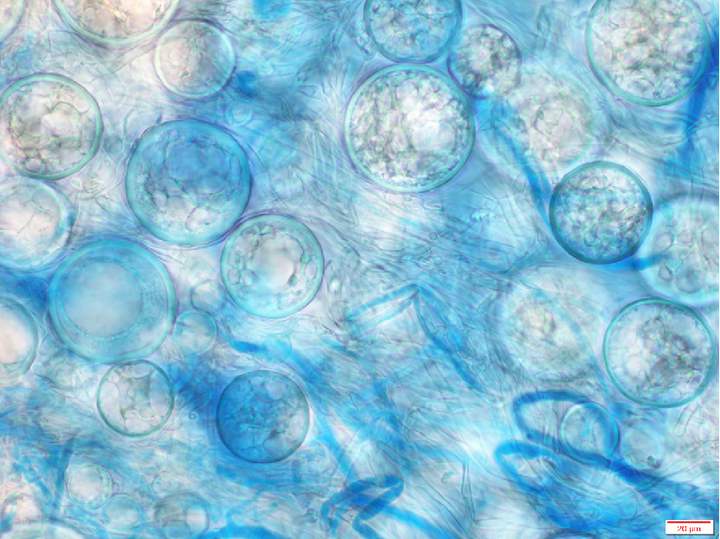 Mikroskopische Aufnahme der Chlamydosporen von Phytophthora ramorum