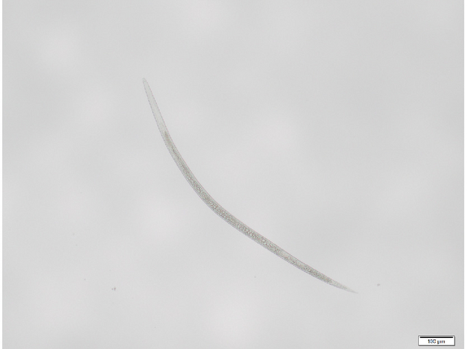 Mikroskopische Aufnahme einer Larve des Stängelälchens