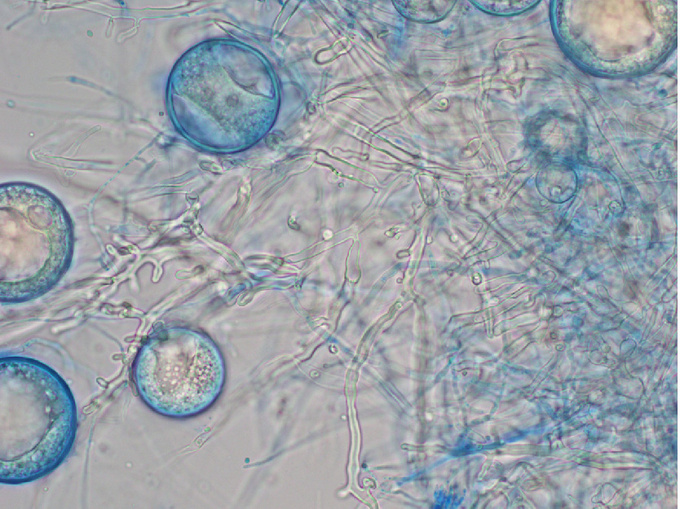 Mikroskopische Aufnahme der Chlamydosporen und koralloides Myzel von Phytophtora ramorum