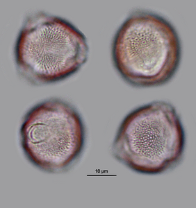 Foto zeigt Pollen des Götterbaums (Vergrößert das Bild in einem Dialog Fenster)