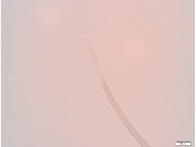 Mikroskopische Detailaufnahme des Kopfbereichs einer Larve des Stängelälchens