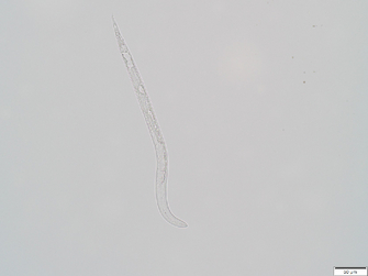 mikroskopische Aufnahme einer Larve mit geknöpftem und zarten Mundstachel des Wurzelgallenälchens