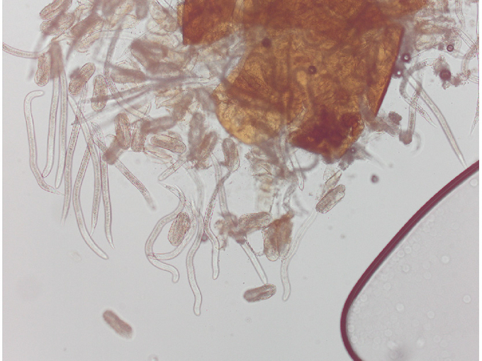 mikroskopische Aufnahme von durchsichtigen Eiern und Larven, die aus der braunen Zyste schlüpfen